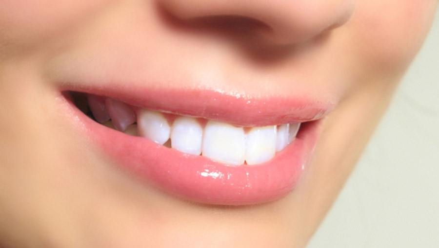 Πλάκα στα δόντια: Πώς θα την αφαιρέσετε με φυσικό τρόπο στο σπίτι