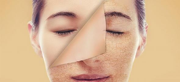 Γιατί το δέρμα σας είναι ξηρό και πώς να το κάνετε απαλό
