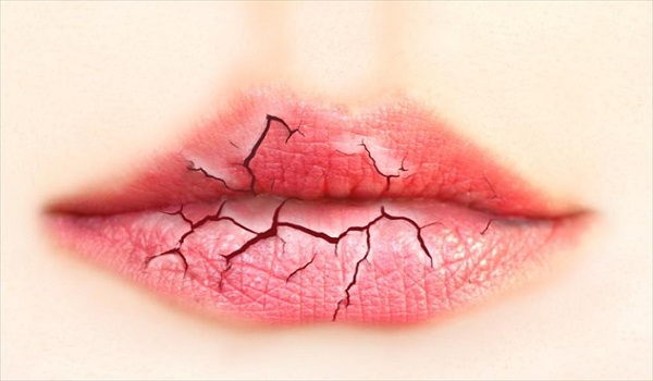 Σκασμένα χείλη: 2 φυσικές συνταγές για βαθιά ενυδάτωση