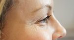 3 Tips για το “πόδι της χήνας” – Αντιμετωπίστε τις ρυτίδες στα μάτια