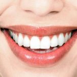Πως θα λευκάνεις τα δόντια σου φυσικά για λαμπερό χαμόγελο.