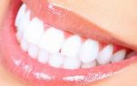Λευκά Δόντια Με Φυσικό Τρόπο
