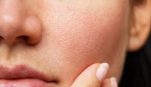Σφιχτό δέρμα χωρίς ρυτίδες: Τι συστήνουν οι κορυφαίοι δερματολόγοι;