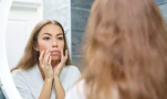 Ξηρό δέρμα γύρω από το στόμα: Αιτίες και θεραπείες
