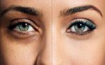 Οι καλύτερες 7 φυσικές θεραπείες για πρησμένα μάτια Άνω και Κάτω βλέφαρα με Σακούλες και Σκιές.