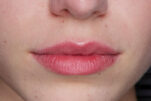 7 tips για να «σβήσεις» τις λεπτές γραμμές και ρυτίδες γύρω από τα χείλη