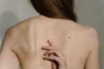 Ελιές στο δέρμα: Ποιες είναι επικίνδυνες και τι προκαλεί την εμφάνισή τους;