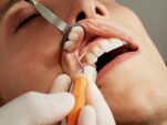 Επαναστατική οδοντιατρική θεραπεία θα καταργήσει απονευρώσεις και σφραγίσματα